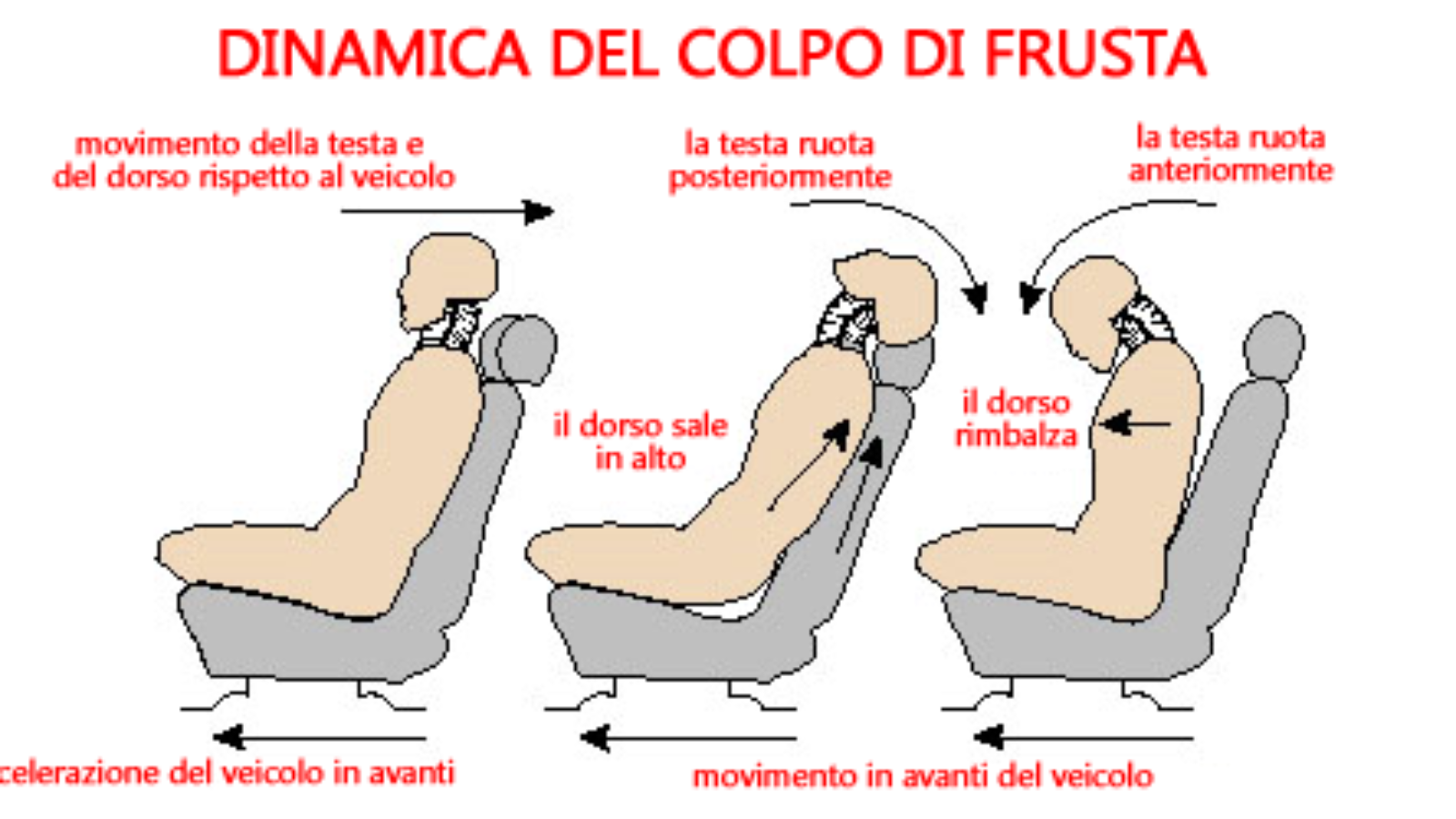 dinamica-del-colpo-di-frusta